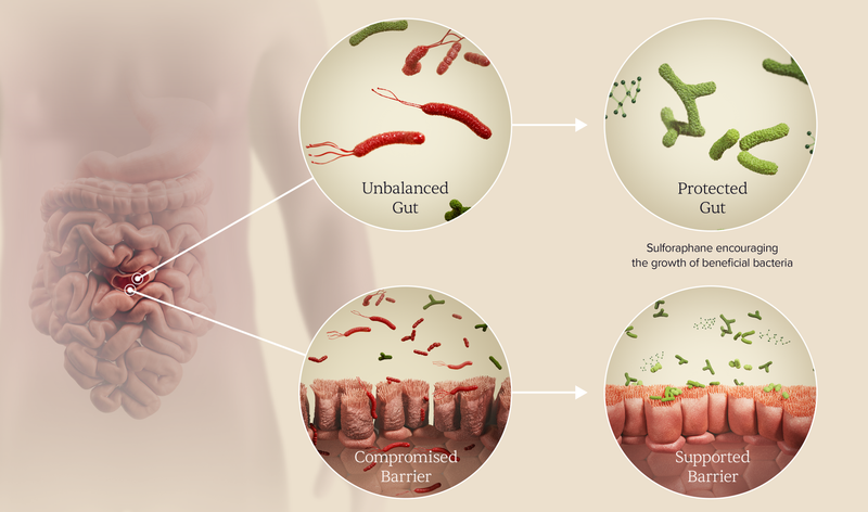 Diagram showing sulforaphane promoting beneficial bacteria and supporting the gut barrier, comparing unbalanced vs protected gut