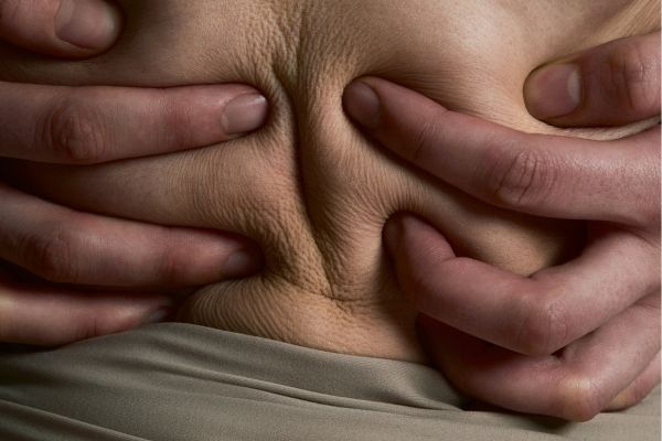 Hands pinching the skin of a bloated abdomen to illustrate gut barrier function and bloating