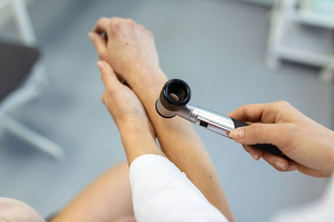 Doctor Examining Patient For Psoriasis
