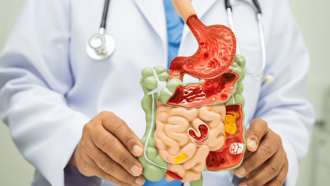 How to Improve Gut Health Using Natural Sulforaphane for Digestive Support